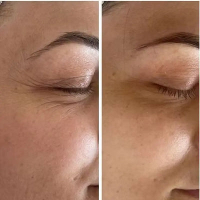 TENSORIX® Tratatamiento Avanzado Tensor Contorno de Ojos con Polisacáridos Marinos 30g